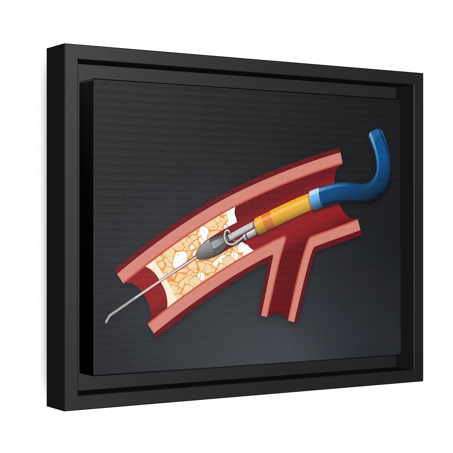 Rotastuck retrieval - canvas