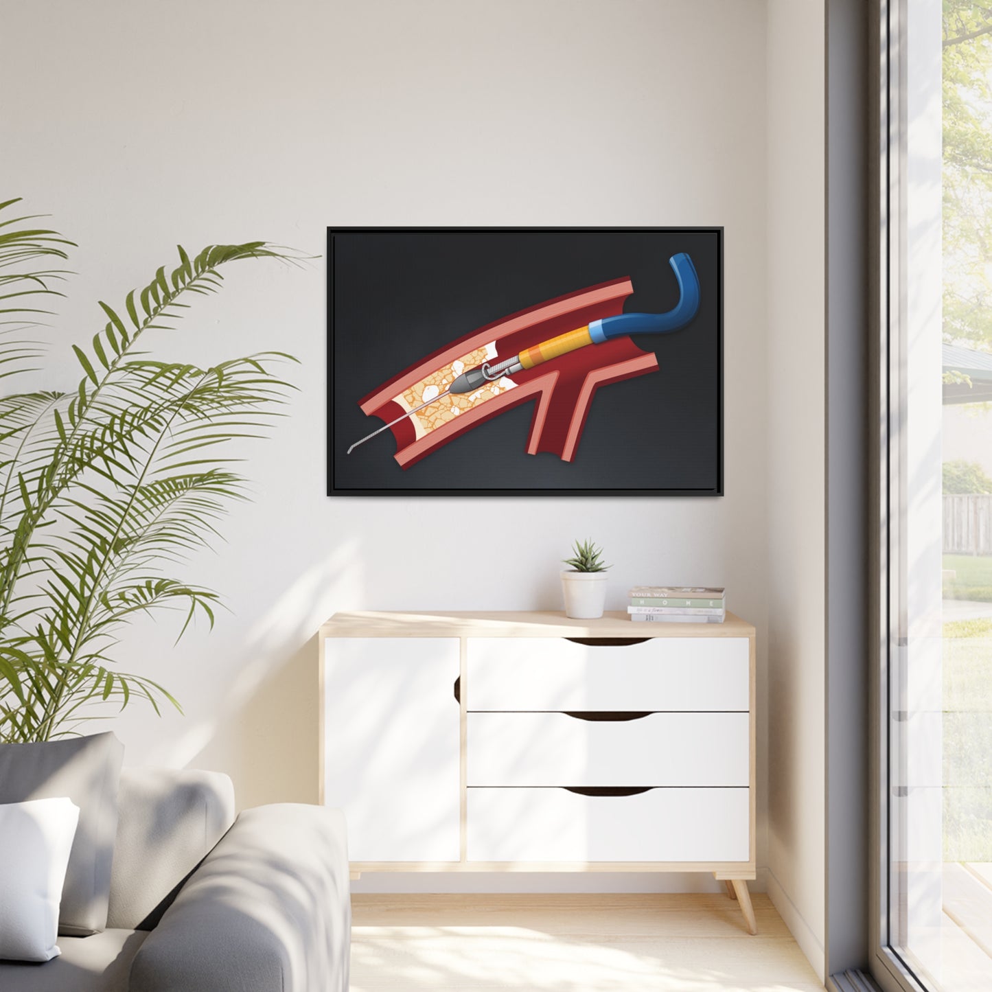 Rotastuck retrieval - canvas