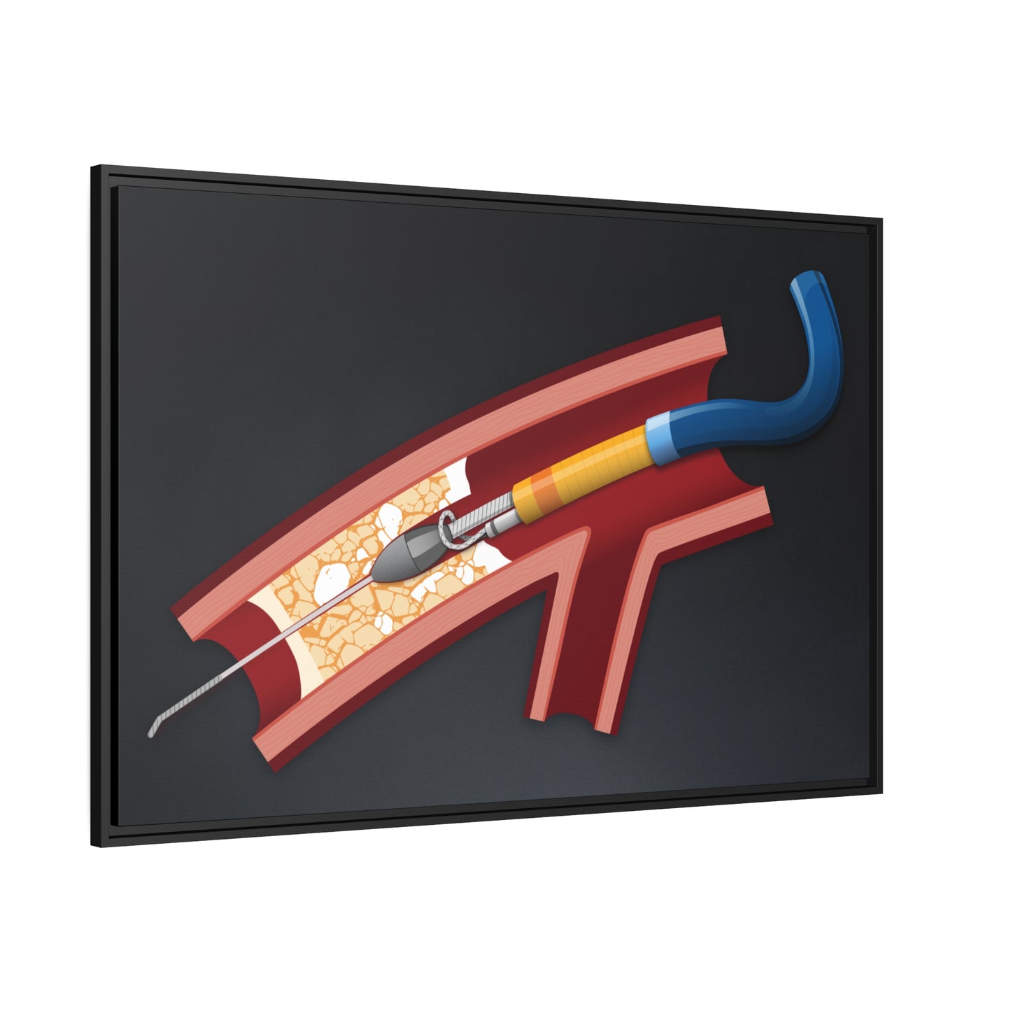 Rotastuck retrieval - canvas