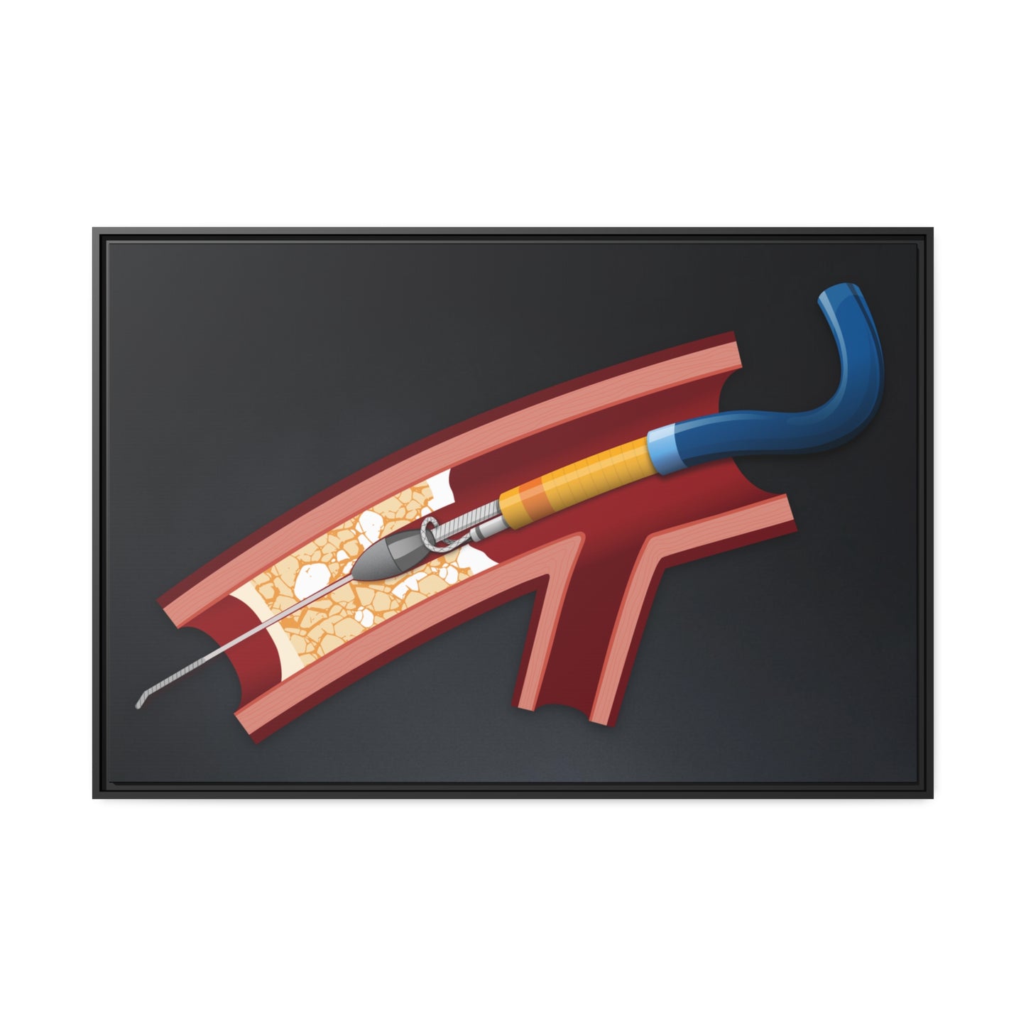Rotastuck retrieval - canvas