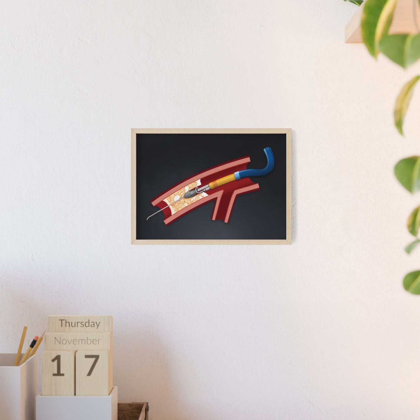 Rotastuck Retrieval Poster framed
