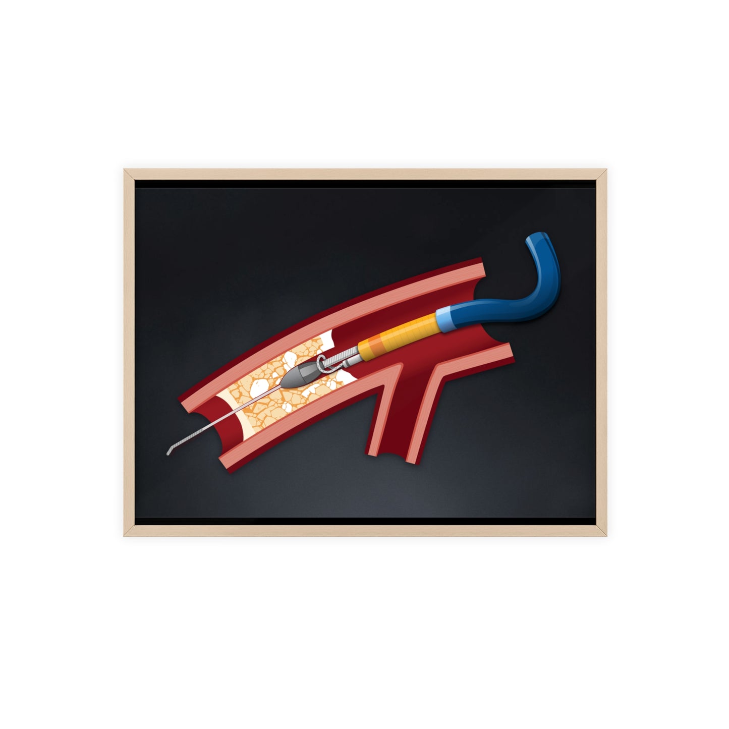 Rotastuck Retrieval Poster framed