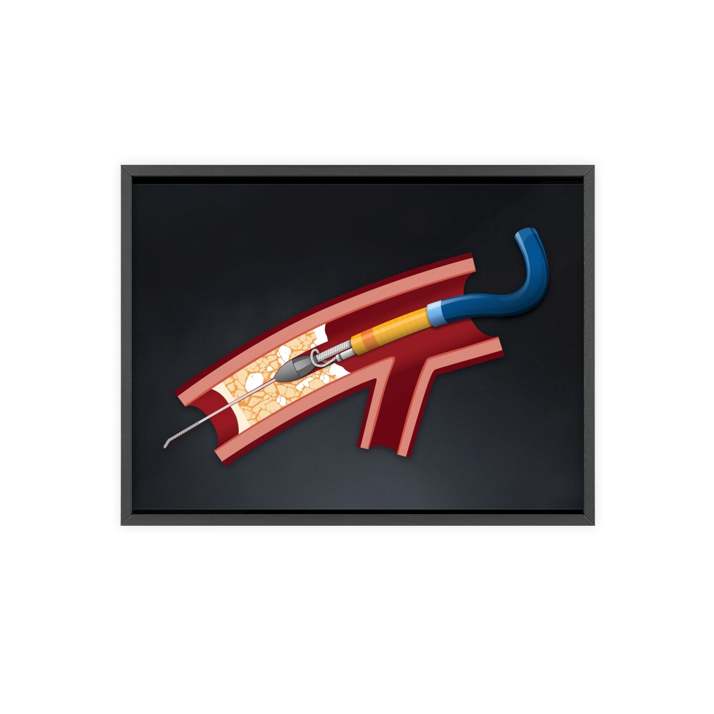 Rotastuck Retrieval Poster framed
